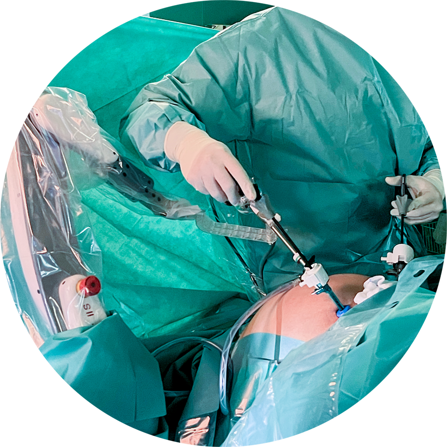 SOLOASSIST IIS surgery